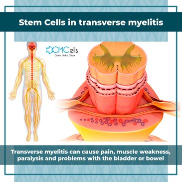 Slider image (2) Cmcells, Centro Medico Celular, (Stem Cells Medical Center)